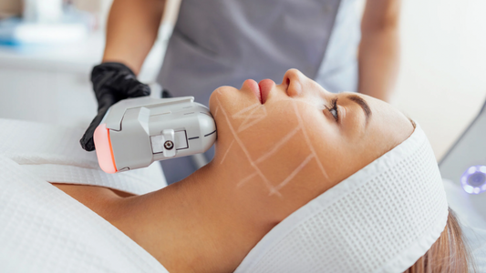 HIFU Facial Treatment