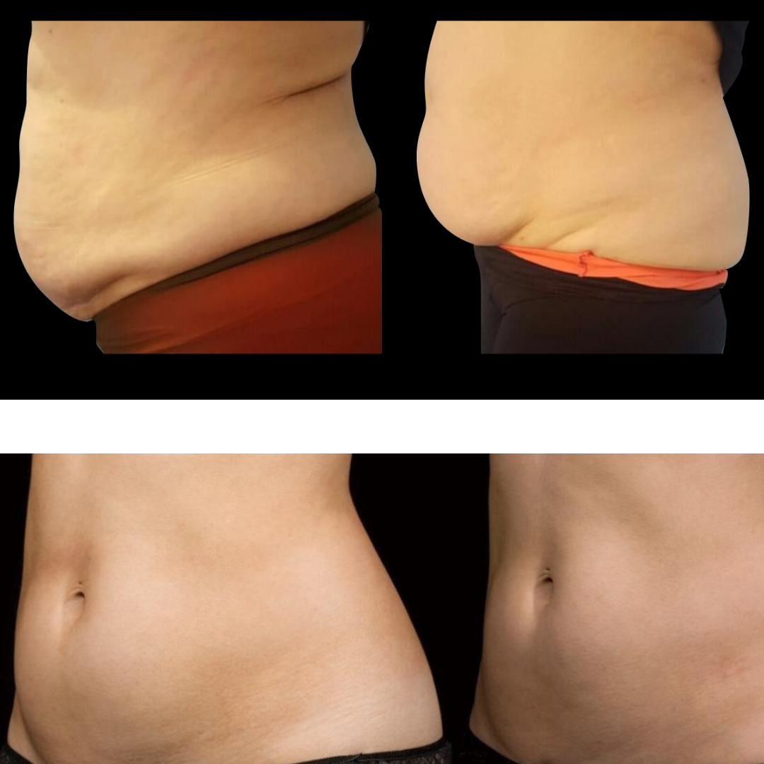 ErisĀ® Lipo Cavitation Machine 9 in 1 Professional