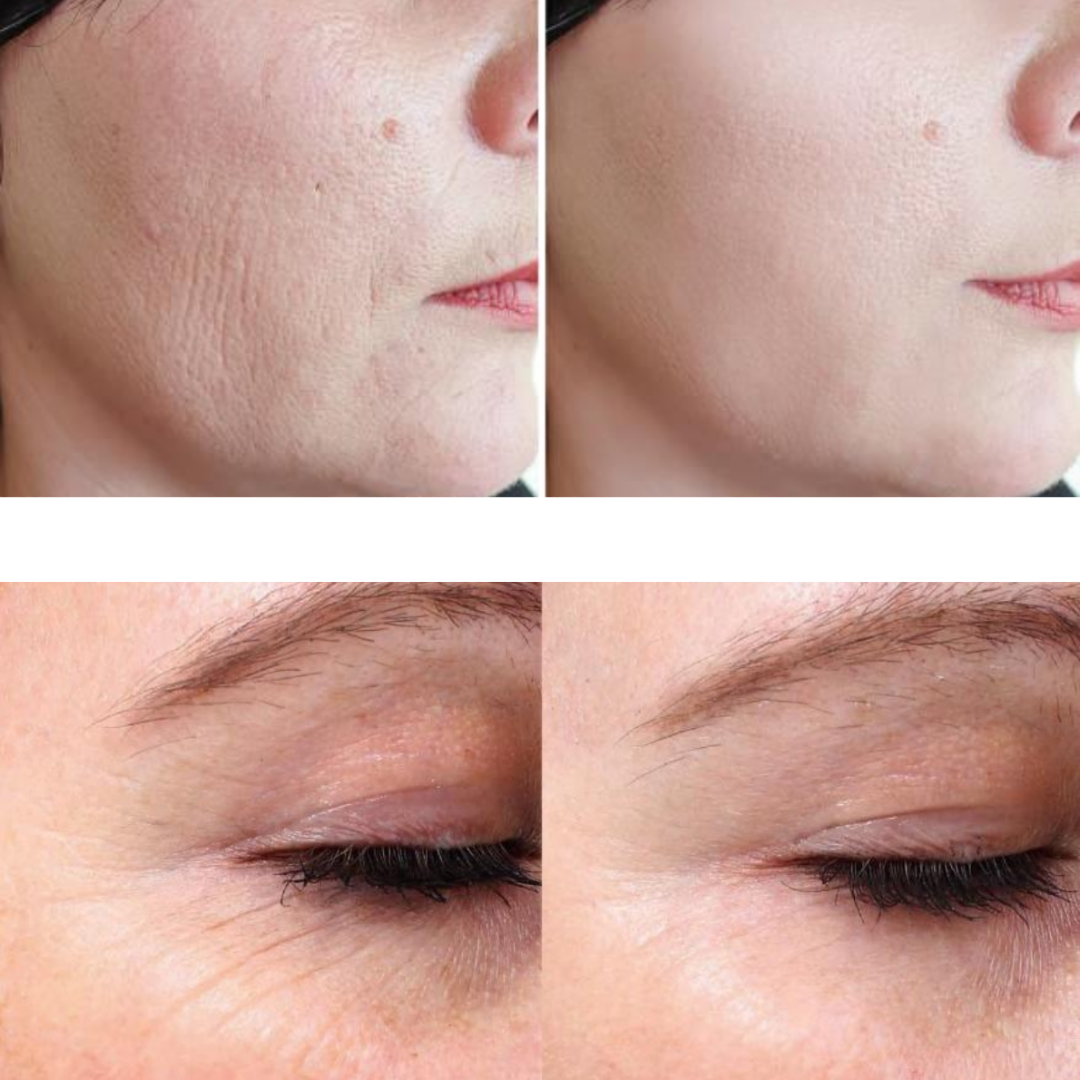 ErisĀ® Lipo Cavitation Machine 9 in 1 Professional