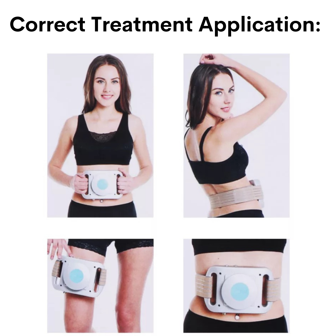 Correct Treatment Application for Cryolipolysis Fat Freezing Machine, Woman wears machine on waistline and thigh areas