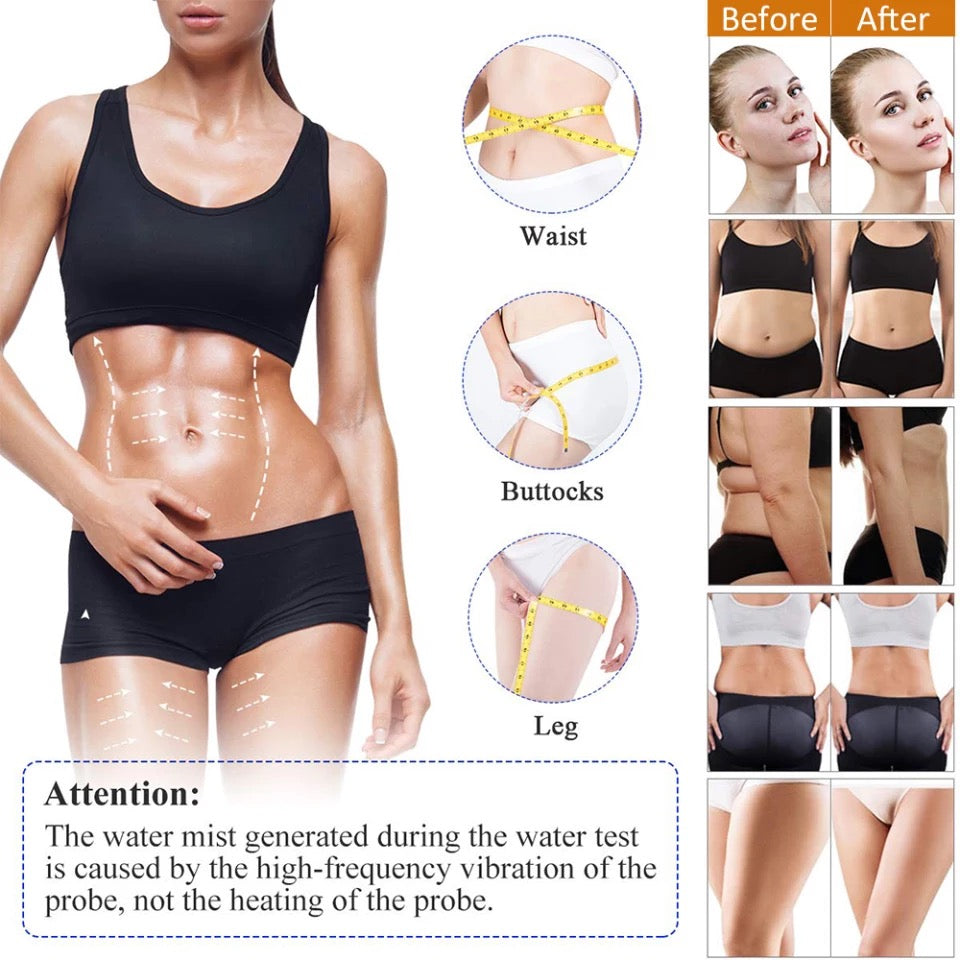 Before & After use of RF Cavitation Machine on Waist Buttocks and Leg 